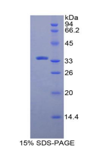 MPG Protein - Recombinant N-Methylpurine DNA Glycosylase By SDS-PAGE