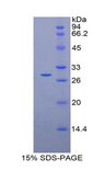 MPS1 / TTK Protein - Recombinant TTK Protein Kinase By SDS-PAGE