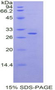 MSN / Moesin Protein - Recombinant Moesin By SDS-PAGE