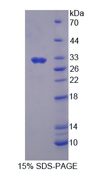 MST1 Protein - Recombinant Macrophage StiMulating Protein By SDS-PAGE