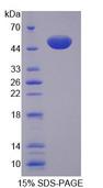 MTIF2 Protein - Recombinant Mitochondrial Translational Initiation Factor 2 (MTIF2) by SDS-PAGE