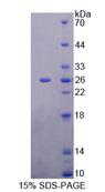 MTUS1 Protein - Recombinant Mitochondrial Tumor Suppressor 1 By SDS-PAGE