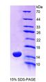MUC5AC Protein - Recombinant  Mucin 5 Subtype AC By SDS-PAGE