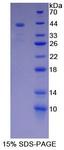 MUC5B Protein - Recombinant Mucin 5 Subtype B By SDS-PAGE
