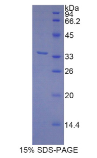 MYH3 Protein - Recombinant Myosin Heavy Chain 3, Skeletal Muscle, Embryonic By SDS-PAGE