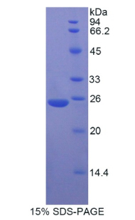 MYH8 Protein - Recombinant Myosin Heavy Chain 8, Skeletal Muscle, Perinatal By SDS-PAGE