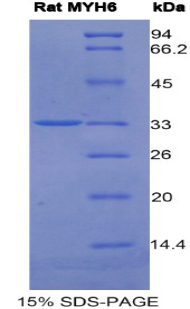 MYHC / MYH6 Protein - Recombinant Myosin Heavy Chain 6, Cardiac Muscle, Alpha By SDS-PAGE
