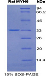 MYHC / MYH6 Protein - Recombinant Myosin Heavy Chain 6, Cardiac Muscle, Alpha By SDS-PAGE