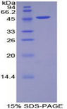MYL6B Protein - Recombinant Myosin Light Chain 6B, Alkali, Smooth Muscle And Non Muscle By SDS-PAGE