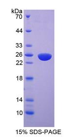 MYLK2 Protein - Recombinant  Myosin Light Chain Kinase 2 By SDS-PAGE