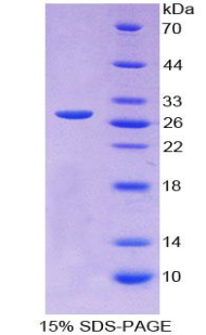 MYOG / Myogenin Protein - Recombinant Myogenin By SDS-PAGE