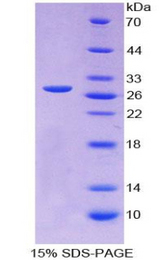 MYOG / Myogenin Protein - Recombinant Myogenin By SDS-PAGE