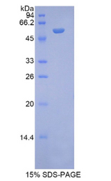 NAGLU Protein - Recombinant N-Acetyl Alpha-D-Glucosaminidase By SDS-PAGE