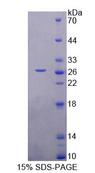 NASP Protein - Recombinant Nuclear Autoantigenic Sperm Protein, Histone Binding By SDS-PAGE