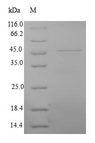 NCAM / CD56 Protein - (Tris-Glycine gel) Discontinuous SDS-PAGE (reduced) with 5% enrichment gel and 15% separation gel.