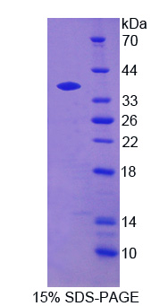 NCAN / Neurocan Protein - Recombinant Neurocan By SDS-PAGE