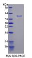 NCOA3 / SRC-3 / AIB1 Protein - Recombinant Nuclear Receptor Coactivator 3 By SDS-PAGE