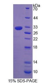 NCR1 / NKP46 Protein - Recombinant Natural Cytotoxicity Triggering Receptor 1 (NCR1) by SDS-PAGE