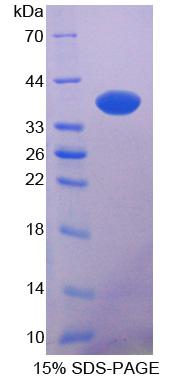 NDRG2 Protein - Recombinant N-myc Downstream Regulated Gene 2 By SDS-PAGE