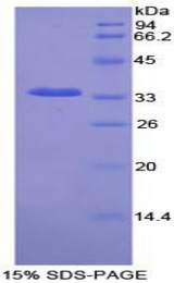 NEK2 Protein - Recombinant Never In Mitosis Gene A Related Kinase 2 By SDS-PAGE
