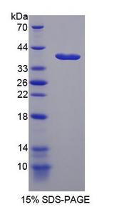 NES / Nestin Protein - Recombinant Nestin By SDS-PAGE