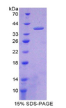 Nesfatin-1 Protein - Recombinant Nesfatin 1 By SDS-PAGE