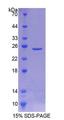 NEU2 / Sialidase 2 Protein - Recombinant  Sialidase 2, Cytosolic By SDS-PAGE