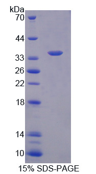 Neurochondrin Protein - Recombinant Neurochondrin By SDS-PAGE