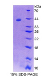 Neurokinin B Protein - Recombinant Neurokinin B By SDS-PAGE