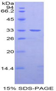 NEXN / Nexilin Protein - Recombinant Nexilin By SDS-PAGE
