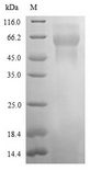 NGN / Neogenin Protein - (Tris-Glycine gel) Discontinuous SDS-PAGE (reduced) with 5% enrichment gel and 15% separation gel.