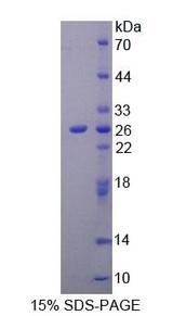 NIN / Ninein Protein - Recombinant Ninein By SDS-PAGE
