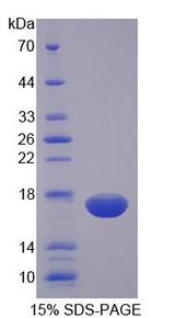 NKP30 Protein - Recombinant Natural Cytotoxicity Triggering Receptor 3 By SDS-PAGE