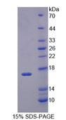 Nor-1 / NR4A3 Protein - Recombinant Neuron Derived Orphan Receptor 1 By SDS-PAGE