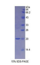 NOS1 / nNOS Protein - Recombinant Nitric Oxide Synthase 1, Neuronal By SDS-PAGE