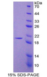 NOS2 / iNOS Protein - Recombinant Nitric Oxide Synthase 2, Inducible By SDS-PAGE