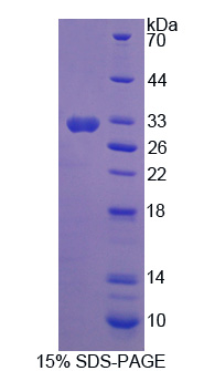 NOSTRIN Protein - Recombinant Nitric Oxide Synthase Trafficker By SDS-PAGE