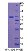 NOSTRIN Protein - Recombinant Nitric Oxide Synthase Trafficker By SDS-PAGE