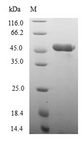 NOX4 Protein - (Tris-Glycine gel) Discontinuous SDS-PAGE (reduced) with 5% enrichment gel and 15% separation gel.