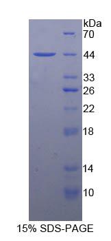 NPHS1 / Nephrin Protein - Recombinant Nephrin By SDS-PAGE