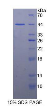 NPHS1 / Nephrin Protein - Recombinant Nephrin By SDS-PAGE