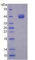 NPPA / ANP Protein - Recombinant Natriuretic Peptide Precursor A (NPPA) by SDS-PAGE