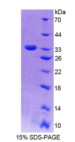 NQO1 Protein - Recombinant  NADH Dehydrogenase, Quinone 1 By SDS-PAGE