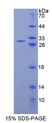 NR0B1 / DAX1 Protein - Recombinant Nuclear Receptor Subfamily 0, Group B, Member 1 (NR0B1) by SDS-PAGE