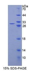 NR0B1 / DAX1 Protein - Recombinant Nuclear Receptor Subfamily 0, Group B, Member 1 (NR0B1) by SDS-PAGE