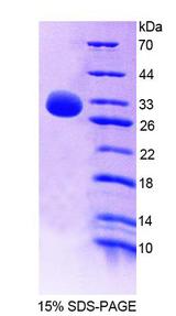 NR0B2 Protein - Recombinant Small Heterodimer Partner By SDS-PAGE