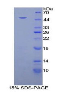 NR3C1/Glucocorticoid Receptor Protein - Recombinant  Nuclear Receptor Subfamily 3, Group C, Member 1 By SDS-PAGE