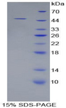 NRP1 / Neuropilin 1 Protein - Recombinant Neuropilin 1 By SDS-PAGE