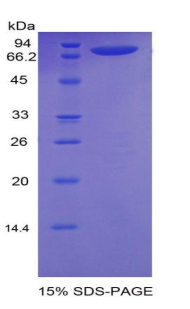 NRP1 / Neuropilin 1 Protein - Recombinant Neuropilin 1 By SDS-PAGE