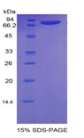 NRP1 / Neuropilin 1 Protein - Recombinant Neuropilin 1 By SDS-PAGE